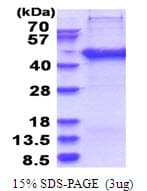 Human SERTAD2 Protein (Recombinant His)