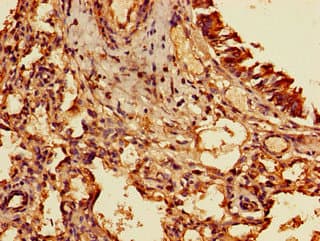 Polyclonal Rabbit anti-Human TIGAR Antibody (IHC, IF)