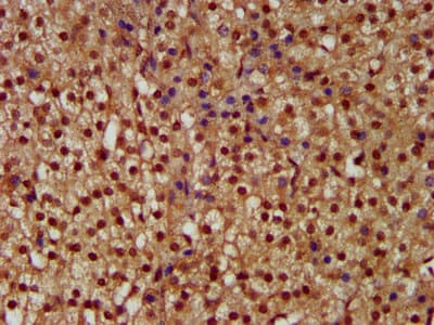 Polyclonal Rabbit anti-Human NEK1 Antibody (IHC, IF)