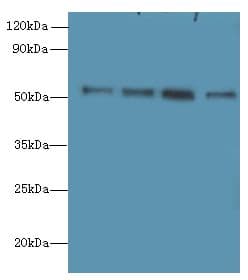 STK38L / NDR2 Antibody