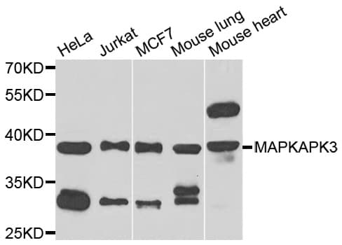 MAPKAPK3 Antibody (AP)