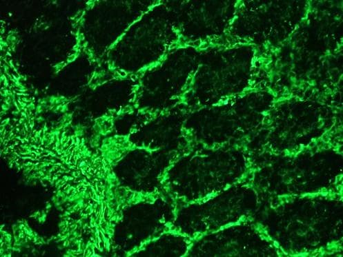 PathPlus™ Vimentin Antibody (clone RV202)