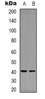 Polyclonal Rabbit anti-Human F12 / Factor XII Antibody (N-Terminus, IHC, WB)