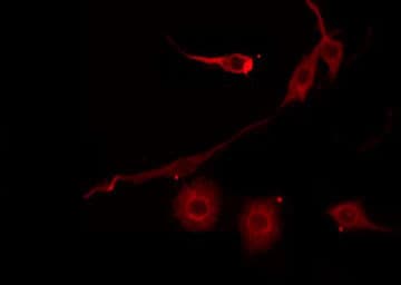 SERPINB7 / MEGSIN Antibody