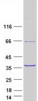 Human ANXA2 / Annexin A2 Protein (Recombinant Myc-DDK (Flag))