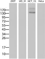 ABCB1 / MDR1 / P Glycoprotein Antibody (aa995-1280, clone 6H2, Carrier-free)