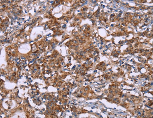 HSP10 / Cpn10 / Chaperonin 10 Antibody