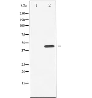 Polyclonal Rabbit anti-Human CHEK1 / CHK1 Antibody (phospho-Ser296, IHC, IF, WB)