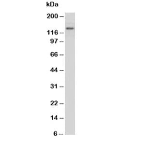 MPO / Myeloperoxidase Antibody (aa714-728)