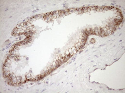 Monoclonal Mouse anti-Human EPLIN Antibody (clone OTI6F7, aa1-275, IHC, WB)