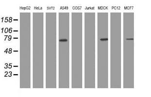 RIPK1 / RIP Antibody (clone OTI1A7)