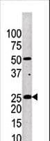 Polyclonal Rabbit anti-Human KLK4 / Kallikrein 4 Antibody (aa85-115, WB)