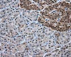 Monoclonal Mouse anti-Human ERCC1 Antibody (clone OTI2E11, IHC, IF, WB)