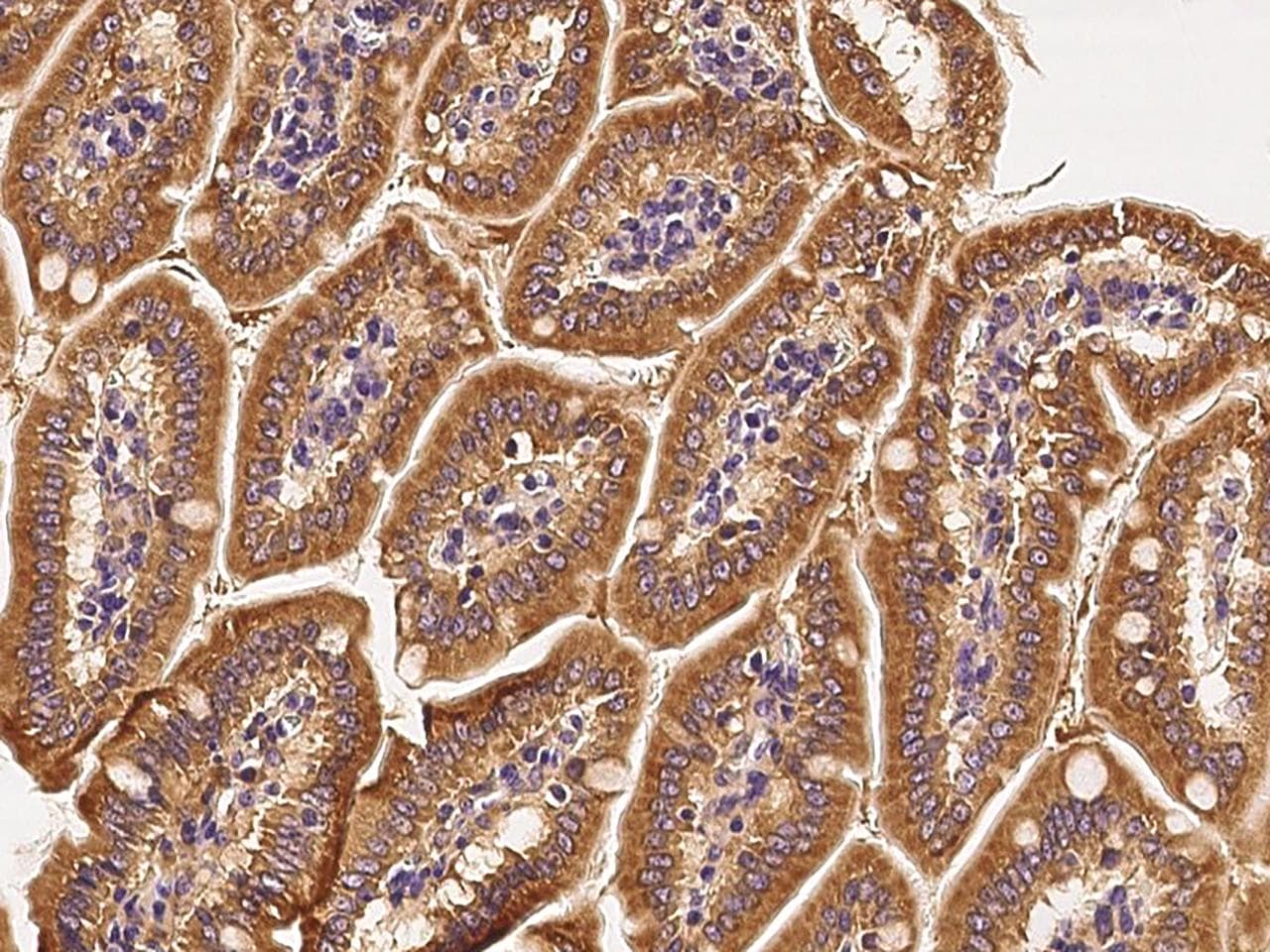 RAB1A Antibody (Preservative Free)