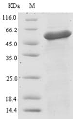 Bacillus subtilis UGL Protein (Recombinant 6His-SUMO, N-terminus)