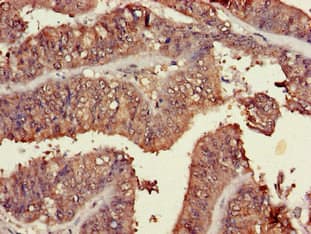 TRIM54 / MURF Antibody