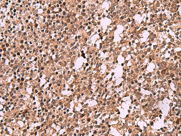 IST1 Antibody