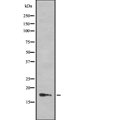 BHLHB40 / HES2 Antibody
