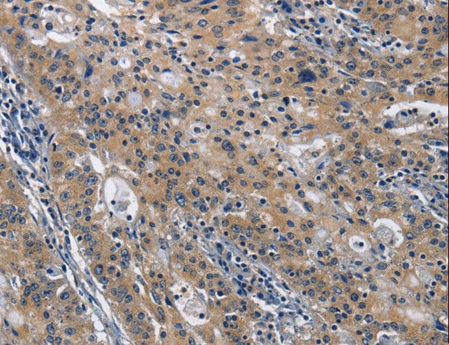 Polyclonal Rabbit anti-Human NK1 / CD160 Antibody (IHC, WB)