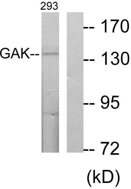 IHC-plus™ Polyclonal Rabbit anti-Human GAK Antibody (aa101-150, IHC, WB)