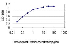 IHC-plus™ HYOU1 / ORP150 Antibody (clone 6F7)