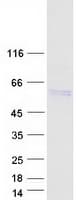 Human SERPINF2 / Alpha-2-Antiplasmin Protein (Recombinant Myc-DDK (Flag))