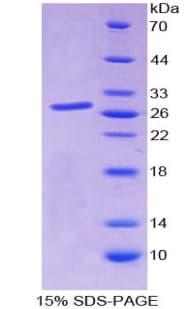 Human SP140 Protein (Recombinant His-T7)