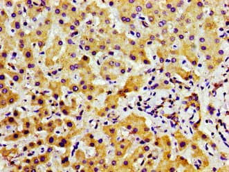 Polyclonal Rabbit anti-Human TAOK2 / TAO2 Antibody (IHC)