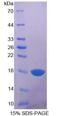 Rabbit LGALS1 / Galectin 1 Protein (Recombinant His-S)