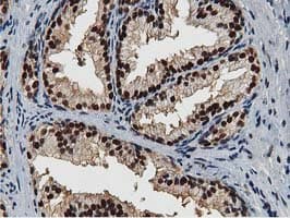NT5DC1 Antibody (clone OTI2A1)