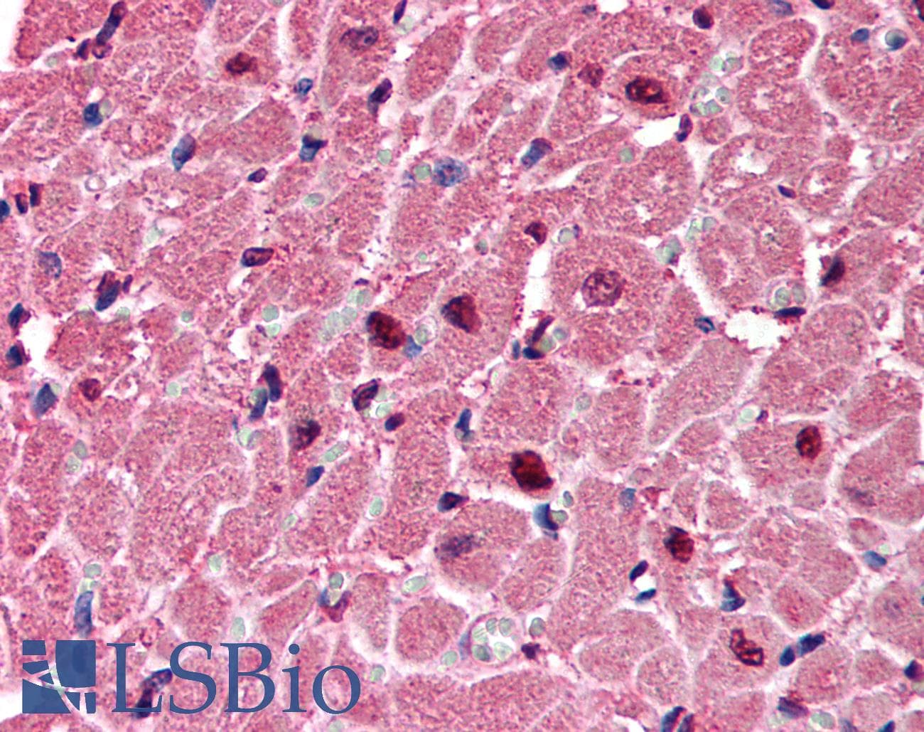 P2RX6 / P2X6 Antibody (aa66-115)