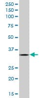 AIMP1 / EMAP II Antibody (clone 3H5)