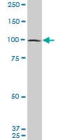 DAP-5 / EIF4G2 Antibody (clone 3B5)
