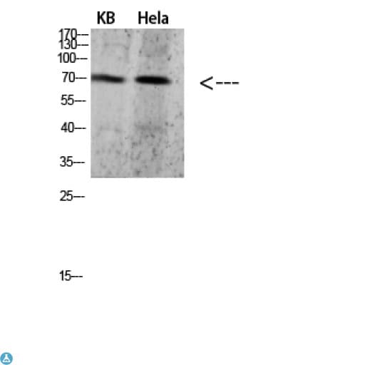 Polyclonal Rabbit anti-Human PRC1 Antibody (WB)