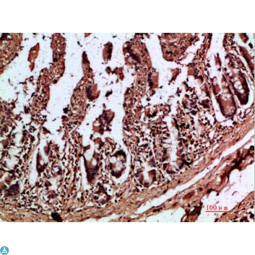Polyclonal Rabbit anti-Human IL17C Antibody (IHC)