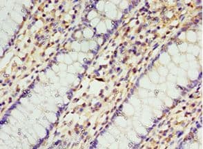 STRAP / MAWD Antibody (aa1-350)