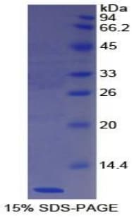 Human Nesfatin-1 Protein (Recombinant His)