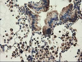 CLPP Antibody (clone OTI1C7)