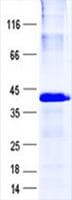 Human LIMS2 Protein (Recombinant His, N-Terminal)
