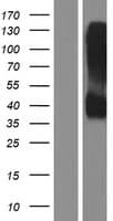 KIR2DL2 / CD158b Protein (Over-Expression Lysate Myc-DDK (Flag))
