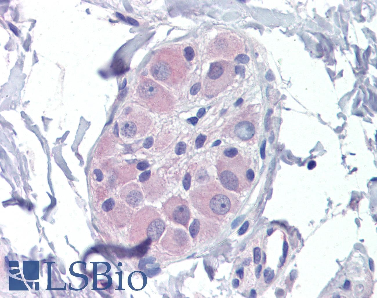 IHC-plus™ PRKAB2 / AMPK Beta 2 Antibody