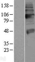 Human SLC18A3 / VACHT Protein (Over-Expression Lysate Myc-DDK (Flag))