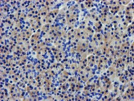 Monoclonal Mouse anti-Human LPL / Lipoprotein Lipase Antibody (clone OTI4F6, IHC, IF, WB)
