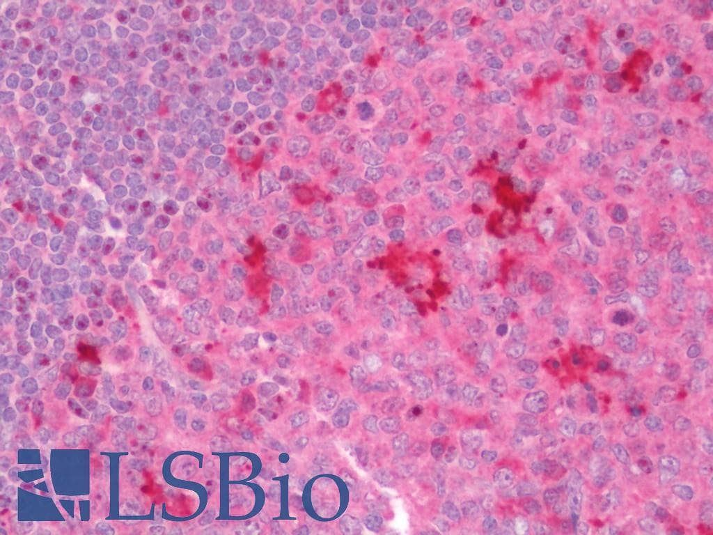 IHC-plus™ NPHP1 / Nephronophthisis Antibody