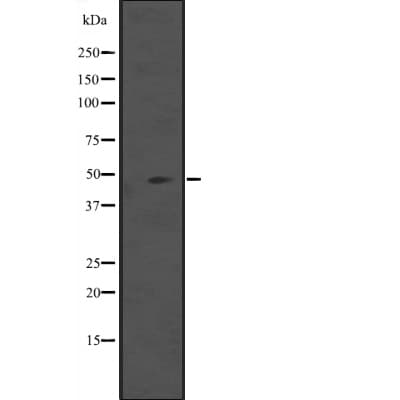 IL5RA / CD125 Antibody