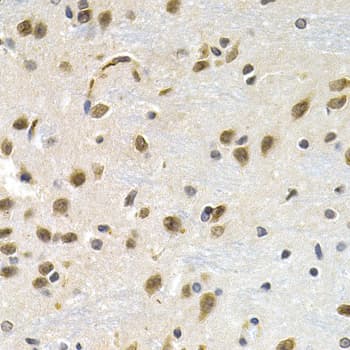 LBR / Lamin B Receptor Antibody