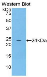 SPTAN1 / Alpha Fodrin Antibody (aa22-210)