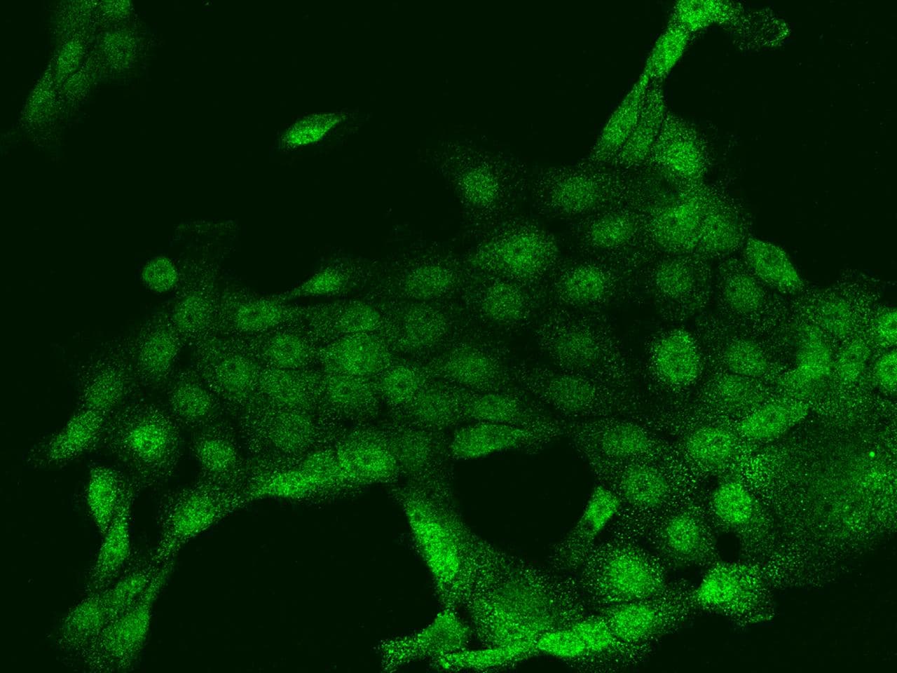 PLA2G4F Antibody