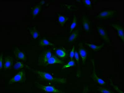 IHC-plus™ Polyclonal Rabbit anti-Human ERGIC3 Antibody (aa47-341, IHC, IF, WB)