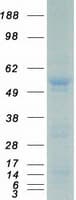 Human ETV6 / TEL Protein (Recombinant Myc-DDK (Flag))